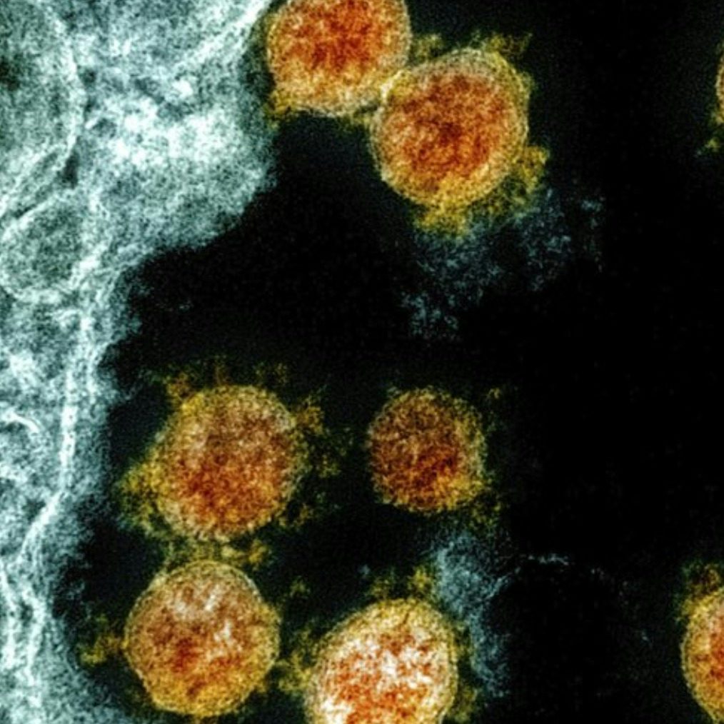 Acute immune signatures and their legacies in severe acute respiratory syndrome coronavirus-2 infected cancer patients