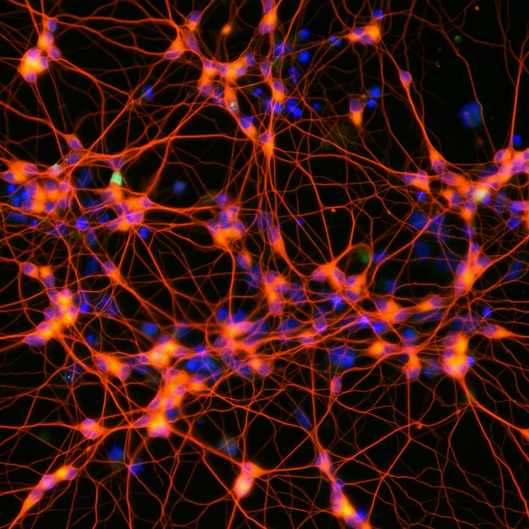 Neuroscience and artificial intelligence