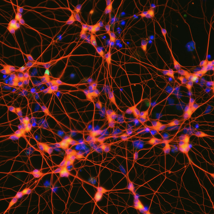 Neuroscience and artificial intelligence